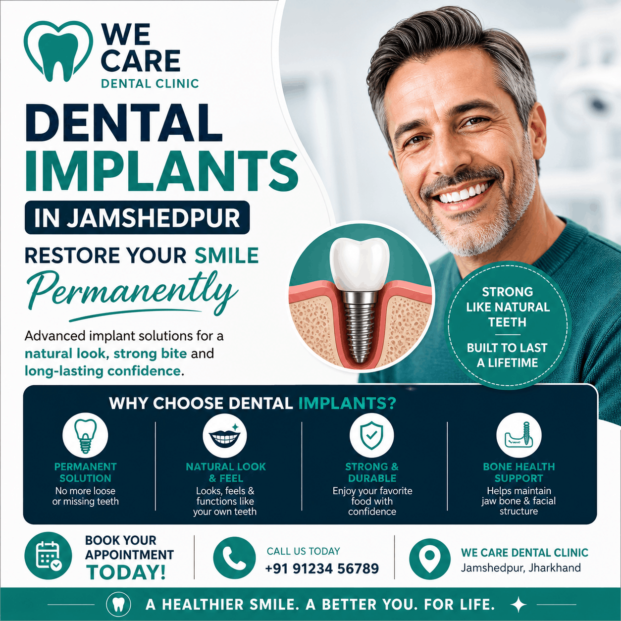 Dental Implants in Jamshedpur